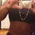 1 month post op