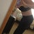 Six weeks post-op