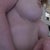 April 8th, 2013--notice the visible incision