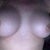 April 8th, 2013--I think it's safe to say that my breasts are not going to even out or fix themselves on their own.