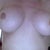Just another beauty shot from today. April 8th, 2013--my breasts literally seem to drift about, but they are rock hard and very uncomfortable. I have rippling and ugliness, but also capsular contracture---and I suspect there is more going on here at this point