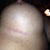 Remember the camera was right next to the incision.  This is 4 months later and really you can't see a thing unless your the camera!!