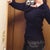 3 weeks post-op; wow, they are no longer resting near my waist--sucess!