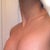 I'm not sure if it's the angle I had taken this picture..but it seems as if my breasts are more swollen today than yesterdays pic. I could account it also to the fact that I'm feeling a LOT more bloated today as well