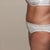 47 Days Post Op (almost 7 weeks)
