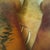 POD 2thighs- bruising is worse today, legs are VERY swollen!