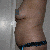 Pre-op Side