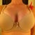 :) 8+ weeks post op 32DD VS measurements