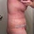 Day 16-still hunched slight curve to back need to get better compression to lower belly