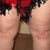 Before Knees12/12