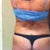 Fat love handles....can't wait to say BYE BYE