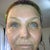 Day 7 1/2 ID mineral cover up to right side of face.  Will practice some blending with bronzer and blush to mask demarcation between face/neck.