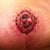 Right nipple graft 18 days post op. top layer of skin is peeling