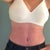 8 weeks post op