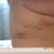 Bruising from the lipo I had under my arms. Nothing serious though. All that ugliness from before was just some drainage trapped under the tapes :)