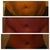 Before, 4 weeks post op, 3.5 months post op