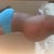 Almost 3 Weeks Post Op