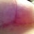 Right under breast. Haven't done anything different.