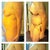 Left Pre-op, 4 days post, 11 days post, 25 days post
