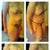 Right Pre-op, 4 days post, 11 days post, 25 days post