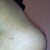 5 months