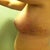 Post Op Day 19--second day without tape on incisions