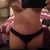 7 weeks post op..belly still swollen