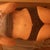 12 weeks post-op