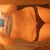 12 weeks post-op