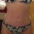 6 months post op