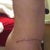 Side view showing scar