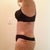 day 6 PO. tummy is tight but i feel like a tree trunk- and my thighs are still bigger than i'd hoped (+ swelling)  and i have lots bruising, but its starting to turn yellow of