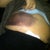 first day right rib cage