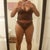 12 Days Post-Op