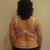 before back view