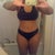 2 months post op