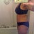 2 months post op