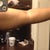 Pre-op: (Left) Arm