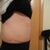 2 weeks post op side view