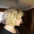 This is a side view. The surgery has relaxed into a more natural me. Hope you like my new hair. I sure do!