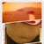 after i got the cool sculpting in my lower and two upper abdominal area