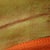 Close up of my scar 18 Days PO.