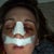 Day after surgery