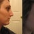 before and after