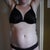 Before tummy tuck