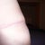 14 weeks 2 days PO.....dog ear