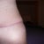 14 weeks 2 days PO......dog ear