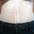 3 weeks post op--FINALLY fitting into my jeans comfortably!
