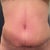 Here you can see the ridge on my waist...in the pic its on the left...
