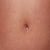 navel scar so far...see the lil opening it has now,yet it's still lopsided :/ 4/26/13